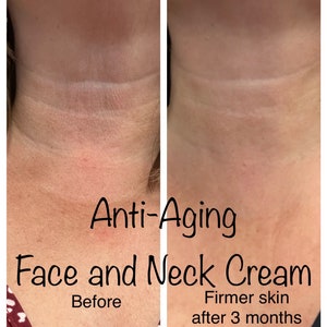 Crème anti-âge pour le visage et le cou Entièrement naturelle Acide hyaluronique DMAE Crème hydratante éclaircissante pour le visage image 1