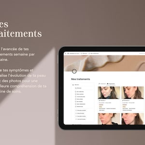 Carnet Skincare : modèle Notion en français dédié à ta peau Collection de produits, routines, journal de peau, suivi de traitements... image 6
