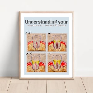 Poster für Zahnfleischerkrankungen, Pardontalerkrankungen, Parodontisten, zahnbehandlungsdekor, zahnbehandlungsdekor, zahnbehandlungsdekor