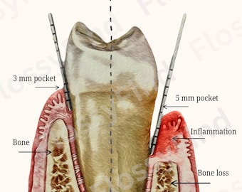 digital download tooth chart, downloadable periodontal print, PNG tooth poster, periodontal disease patient education wall art