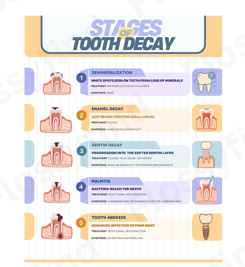 Colorful Stages of Tooth Decay Poster | Dental Humor Art Print | Unique ...