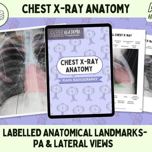 Chest X-ray Anatomy, PA and Lateral Views for Rad Techs, Radiographers, Radiologists, Doctors, Physios, Students & Teachers, Medical Imaging