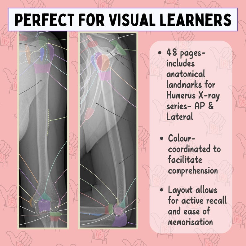 Humerus X-ray Anatomy Study Guide: AP & Lateral Views (PDF) - Etsy