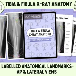 2025 Tibia & Fibula X-ray Anatomy, AP and Lateral Study Bundle for Rad Techs, Radiographers, Radiologists, Doctors, Physios and Students