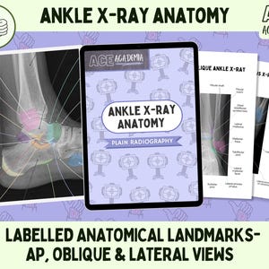 2025 Ankle X-ray Anatomy, AP Oblique & Lateral Radiography Study Bundle  for Rad Techs, Radiographers, Radiologists, Doctors, Students