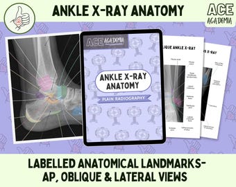 2026 Ankle X-ray Anatomy, AP Oblique & Lateral Radiography Study Bundle  for Rad Techs, Radiographers, Radiologists, Doctors, Students