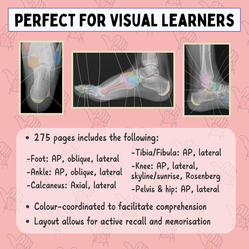 2026 Lower Limb X-ray Anatomy Bundle 275 Pages, Radiography Study ...
