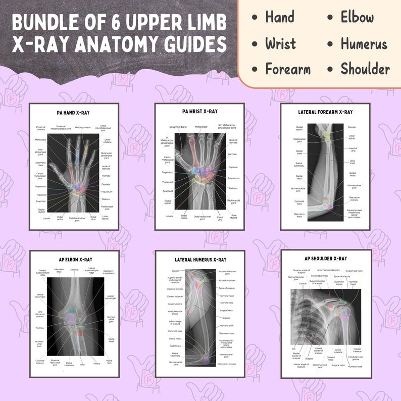 Upper Limb X-ray Anatomy Study Bundle: Radiography (PDF) - Etsy