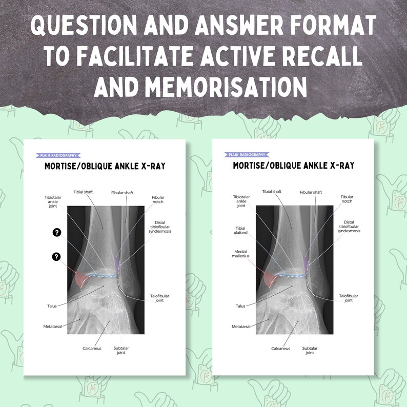2026 Ankle X-ray Anatomy, AP Oblique & Lateral Radiography Study Bundle ...