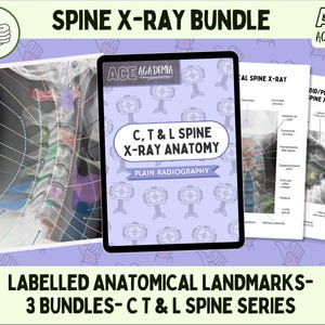 Cervical, Thoracic & Lumbar Spine Anatomy Bundle 2025, Radiography Study Bundle for Rad Techs, Radiographers, Radiologists, Doctors, Student