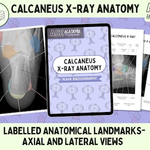 May include: A digital illustration of a labeled anatomical diagram of the calcaneus bone, also known as the heel bone, in an X-ray image. The diagram shows the axial and lateral views of the calcaneus bone, with labels for the different anatomical landmarks. The text "CALCANEUS X-RAY ANATOMY" is displayed at the top of the image.
