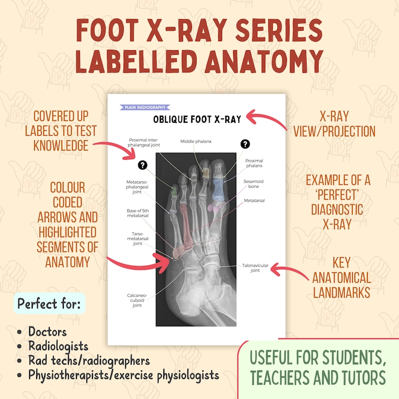 2025 Foot X-ray Anatomy, AP Oblique & Lateral Radiography Study Bundle ...