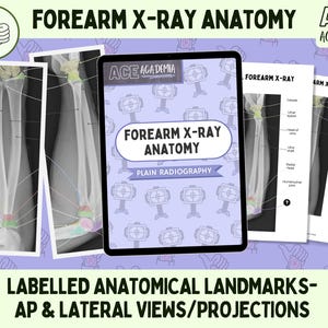 2025 Forearm X-ray Anatomy, AP and Lateral Study Bundle for Rad Techs, Radiographers, Radiologists, Doctors, Physios, Students & Teachers