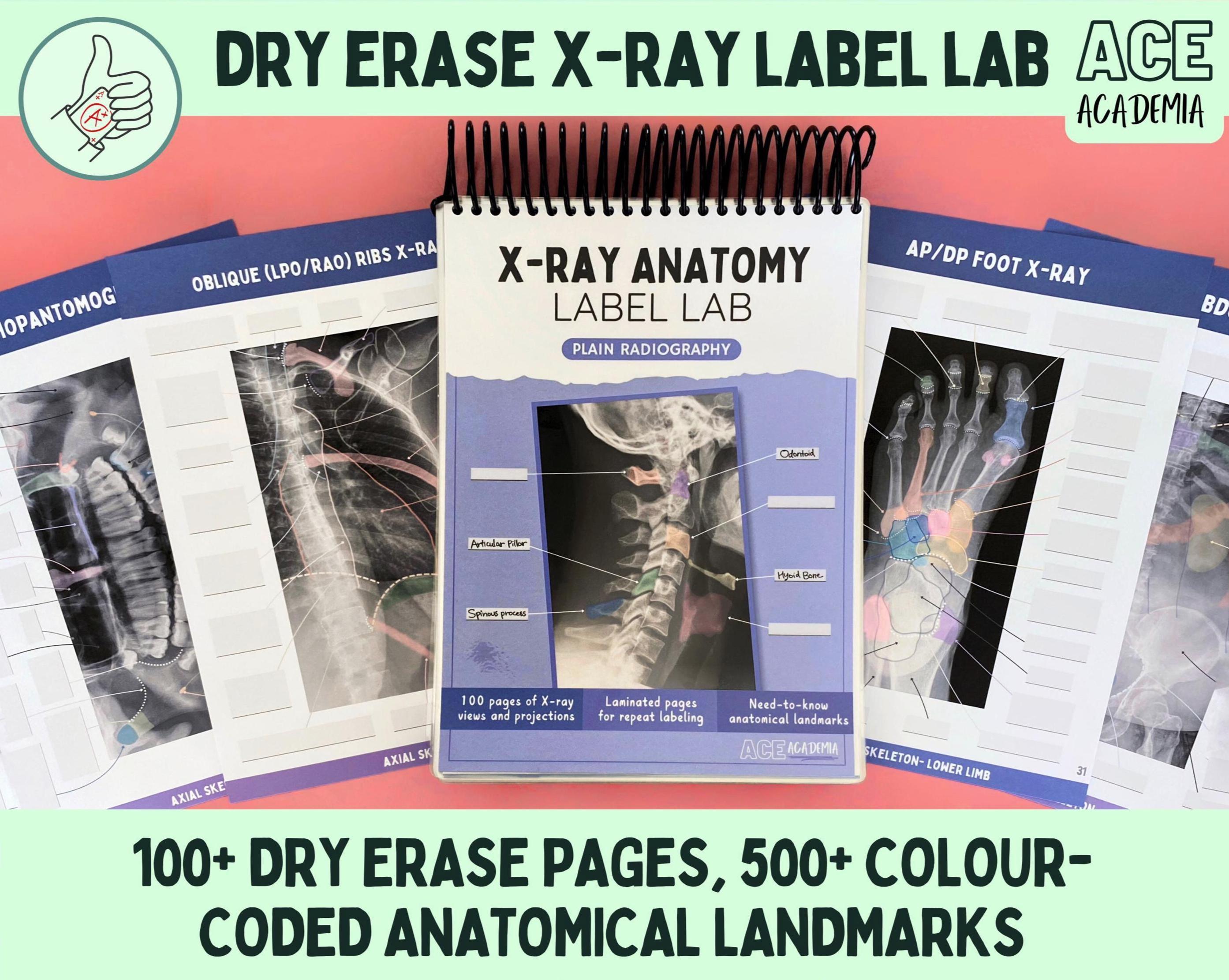 The X-ray Anatomy Label Lab Dry Erase Workbook, 100+ Pages of X
