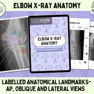 May include: Anatomy study materials featuring elbow X-ray images. The images include labeled anatomical landmarks in AP, oblique, and lateral views. The text "ELBOW X-RAY ANATOMY" and "PLAIN RADIOGRAPHY" are visible. The Ace Academia logo is also present.
