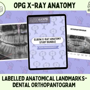 2025 OPG Anatomía radiográfica dental, ortopantograma para técnicos en radiología, radiólogos, dentistas, ortodoncistas, médicos y estudiantes