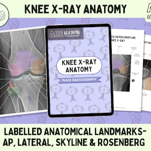 Knee X-ray Anatomy, AP Lateral Skyline and Rosenberg Views for Rad Techs, Radiographers, Radiologists, Doctors, Physios, Students & Teachers