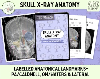 頭蓋骨X線解剖学、PA/Caldwell、OM/Waters & Lateral、2025年放射線