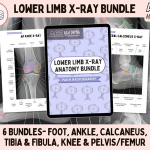 2025 Lower Limb X-ray Anatomy Bundle 275 Pages, Radiography Study Bundle for Rad Techs, Radiographers, Radiologists, Doctors, Students