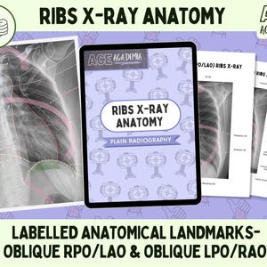 2025 Ribs X-ray Anatomy, Oblique RAO and LAO Views for Rad Techs, Radiographers, Radiologists, Doctors, Students, Medical Imaging