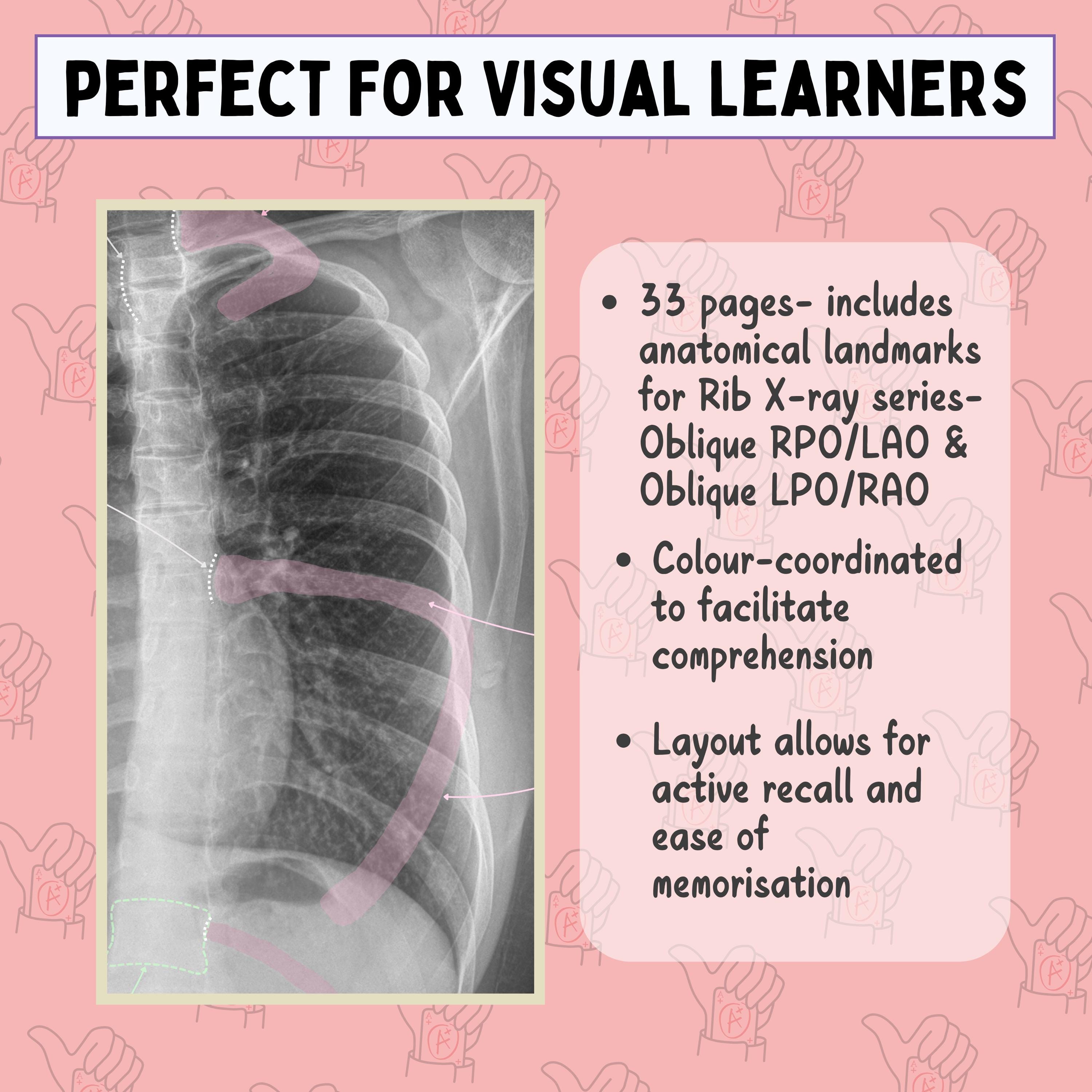 Rib X-ray Anatomy Study: Oblique Views, Labeled Landmarks (PDF) - Etsy
