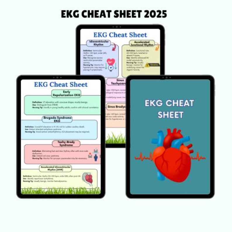 EKG Dysrhythmia Cheat Sheet Bundle: Nursing School Study Guide (digital ...