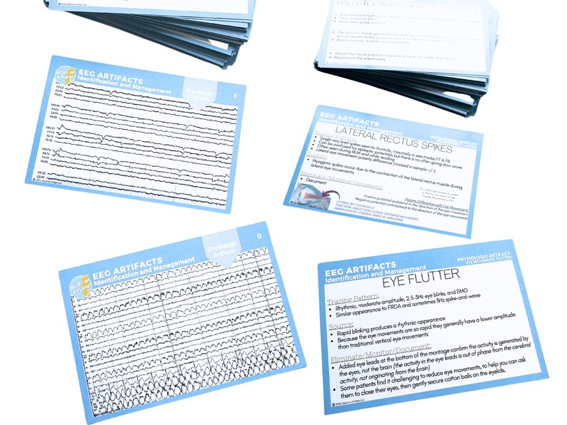 Eeg Math Reference Card EEG Artifacts Flashcards: Neurodiagnostic & Neurology Education - Etsy