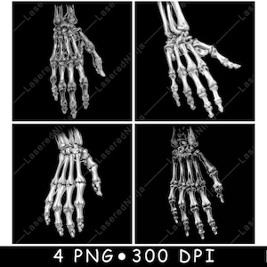 May include: Four black and white images of a detailed anatomical drawing of a human hand skeleton.