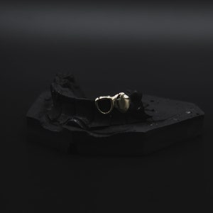 18K &quot;Open Face&quot; Gold Grillz