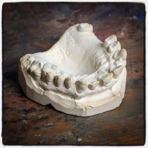 Puede incluir: Un modelo de yeso blanco de una mandíbula humana con dientes, que muestra los dientes superiores e inferiores en posición de boca cerrada.