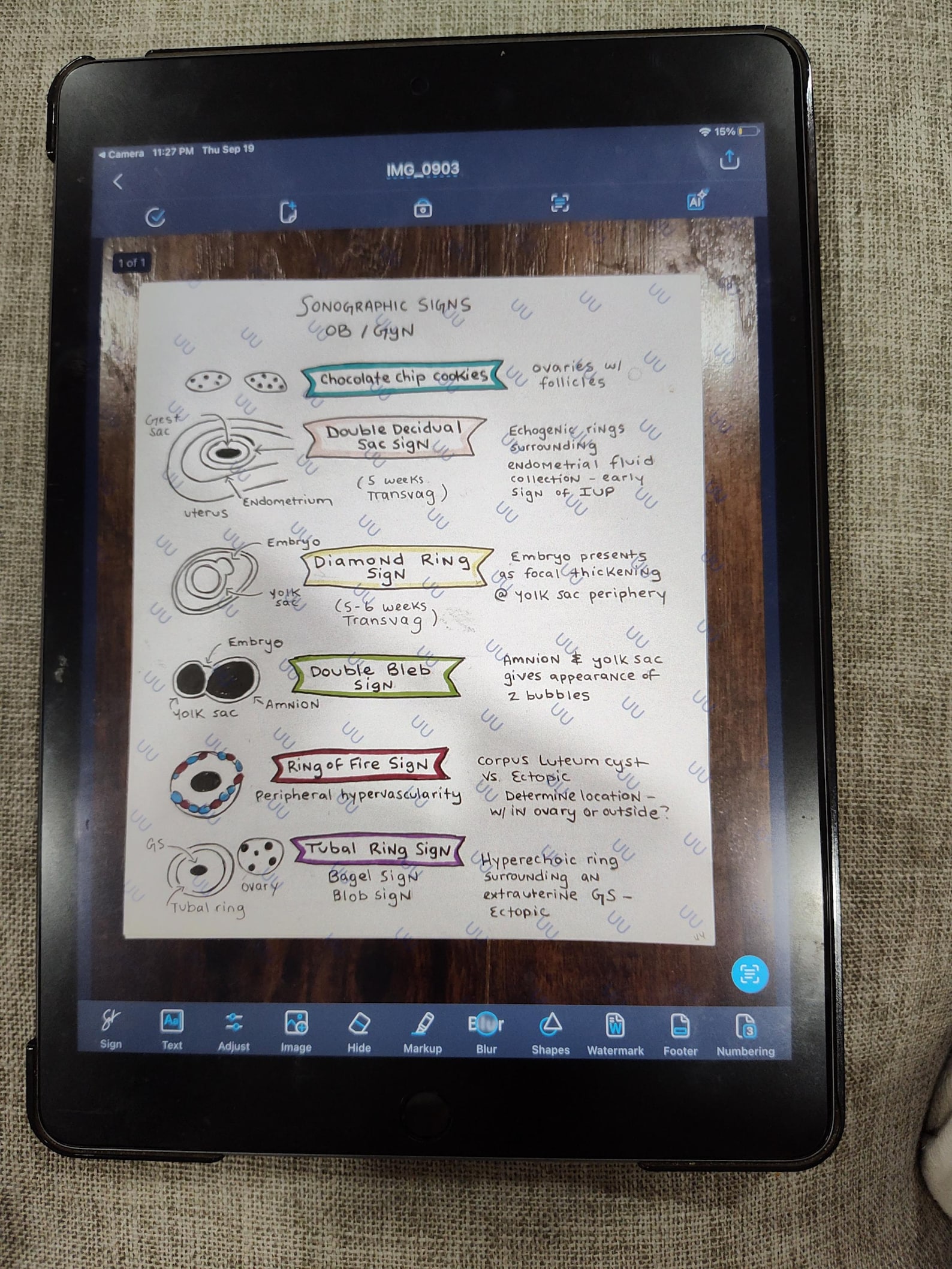 Sonographic Signs (ob/gyn) Visual Reference - Etsy