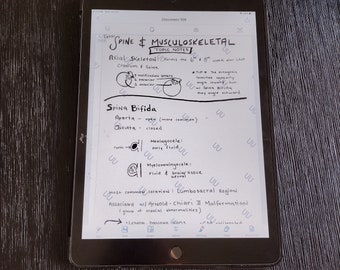 Sonography Visual Study Notes: Fetal Spine and Musculoskeletal Conditions