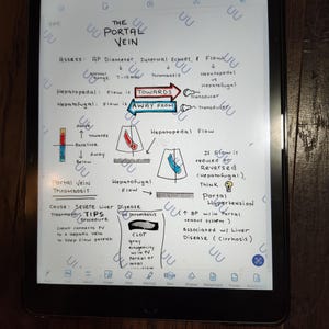 Könnte beinhalten: Handgeschriebene Notizen auf weißem Hintergrund mit einem Diagramm der Pfortader und ihres Flusses. Die Notizen behandeln die Pfortader, ihren Durchmesser, ihre inneren Echos und ihren Fluss. Die Notizen behandeln auch die Ursachen und die Behandlung der Pfortaderthrombose. Die Notizen beinhalten den Text "The Portal Vein", "Assess: AP Diameter, Internal Echoes, & Flow", "Hepatopedal: Flow is TOWARDS", "Hepatofugal: Flow is AWAY FROM", "Portal Vein Thrombosis", "Cause: Severe Liver Disease", "Treatment: TIPS Procedure", "PV Thrombosis", "CLOT", "Gray echogenicity within PV", "Partial or Total occlusion", "If Flow is reduced or Reversed (Hepatofugal), Think Portal Hypertension", "↑ BP within Portal Venous System", "Associated w/ Liver Disease (Cirrhosis)".