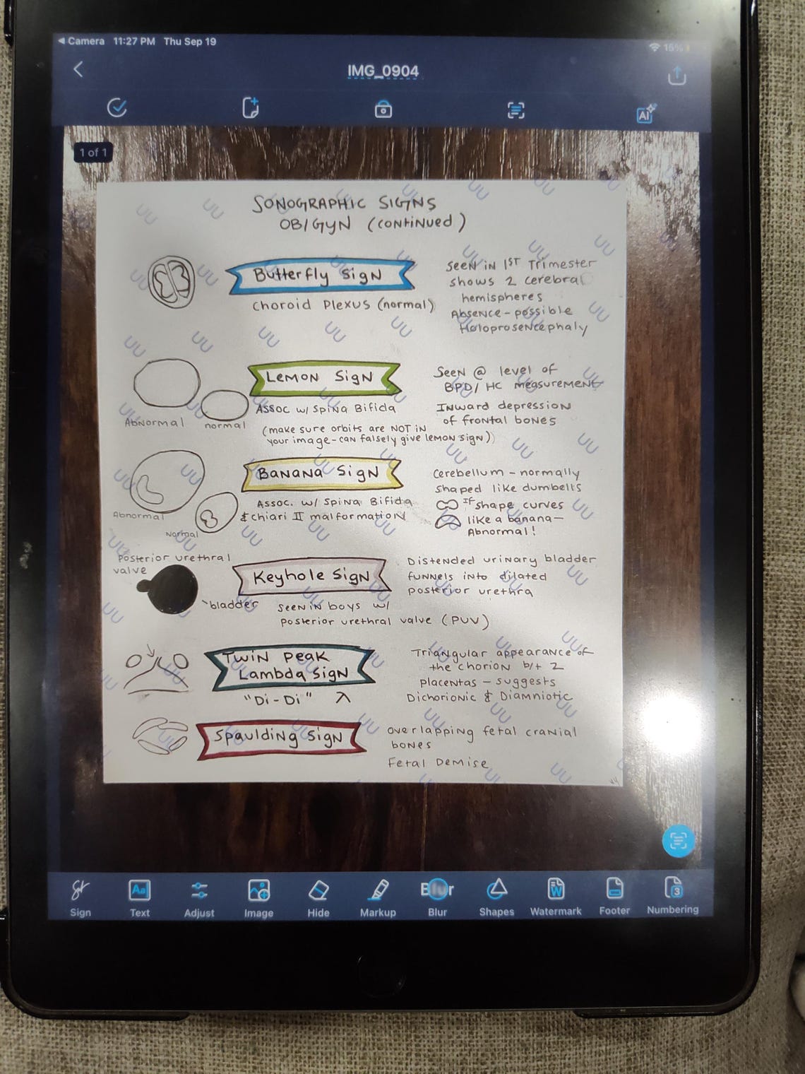 Sonographic Signs (ob/gyn) Visual Reference - Etsy