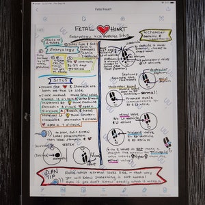 May include: A hand-drawn diagram explaining fetal heart development and anatomy. The diagram includes a heart with four chambers, a foetus in the womb, and a clock face to illustrate the position of the foetus. The text includes terms like "embryology", "4CH anatomy", "Situs", "apex", "atrium", "ventricle", "septum", "foramen ovale", "mitral valve", "tricuspid valve", and "scan tip".
