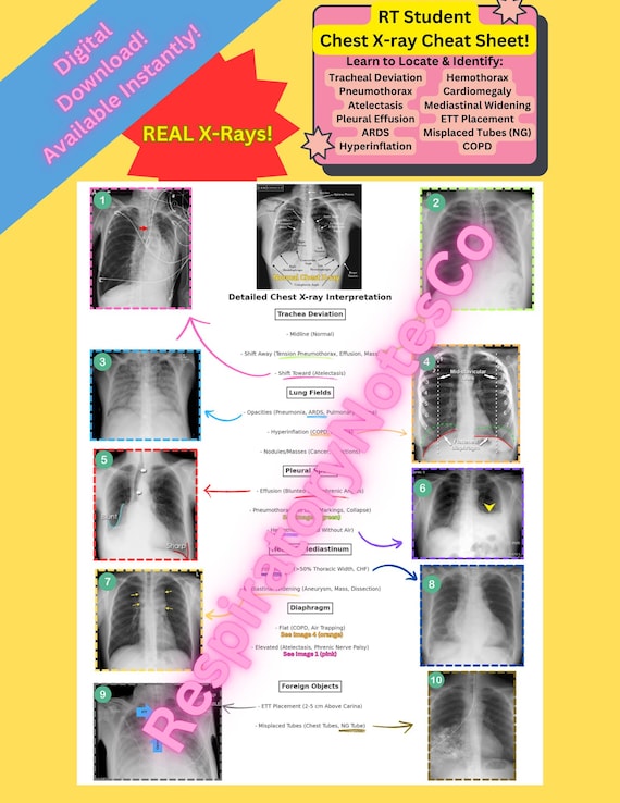 Rayペ-ジ Chest X-ray Interpretation Guide | Respiratory Therapy Cheat Sheet