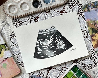 Watercolor Ultrasound Painting Heirloom for Expecting Mothers
