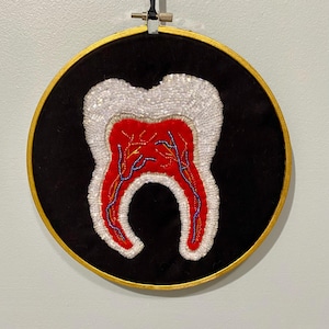 Tooth molar 8.25 beaded embroidery hoop art