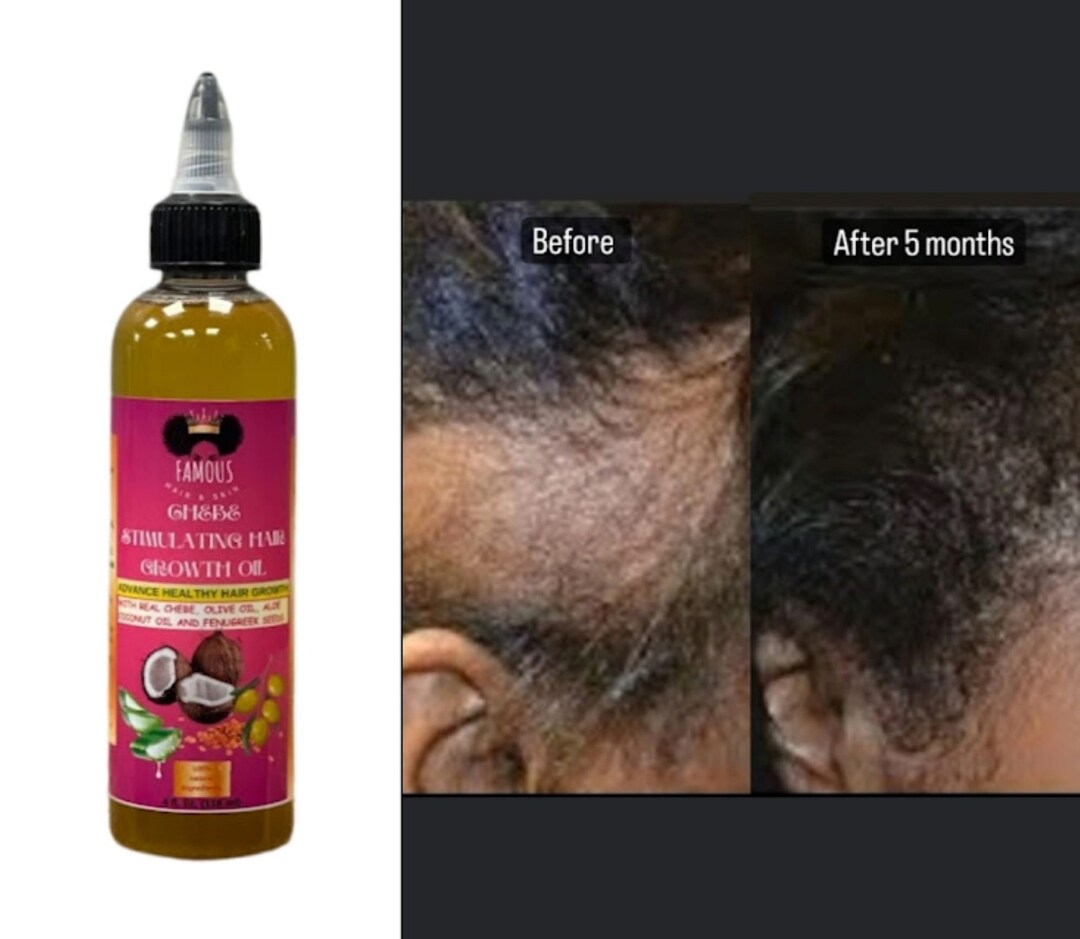 4 Oz Chebe Stimulating Hair Growth Oil With Fenugreek/oil for Split