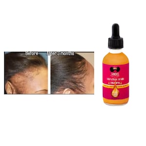 2 Unze  AMAZING HAIR DROPS/ Haartropfen gegen Glatzenbildung/Haarserum für trockenes Haar/Serumöl für Spliss/Ölbehandlung für strapaziertes Haar/ Kantenöl