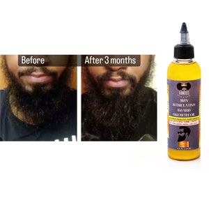 4 oz. MEN STIMULATING Beard growth oil/all natural beard oil/oil treatment for beard/beard growth oil/beard oil for thin hair/beard care