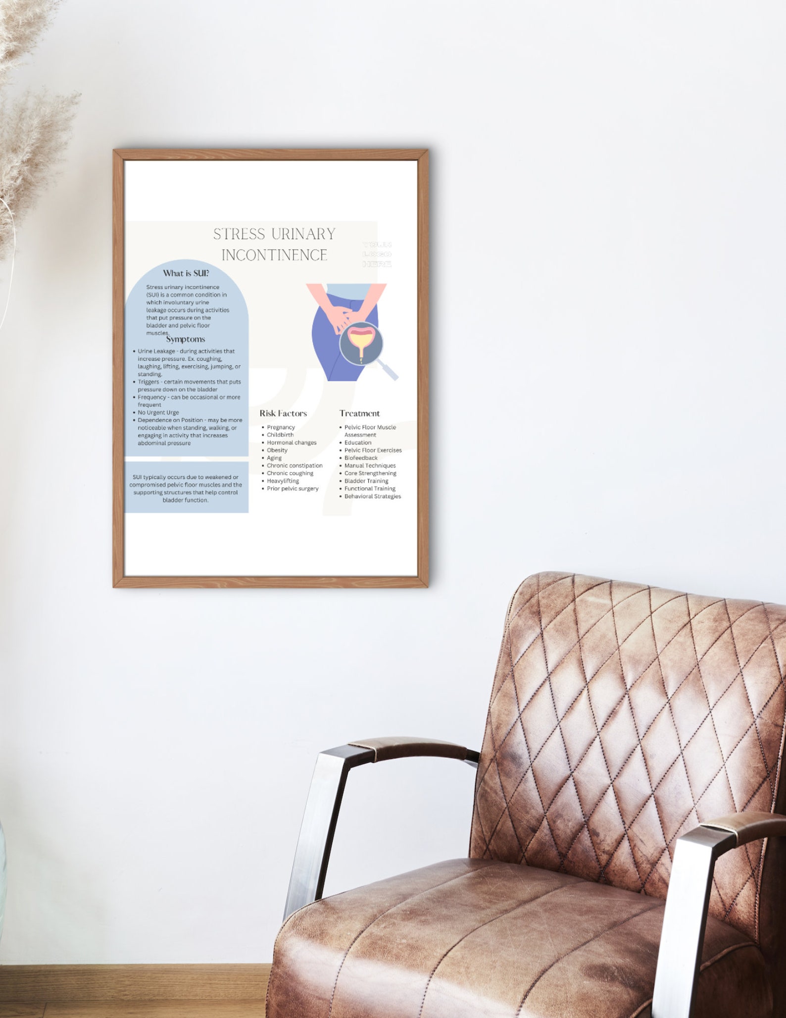 Stress Urinary Incontinence Handout Pelvic Floor Physical Therapy ...