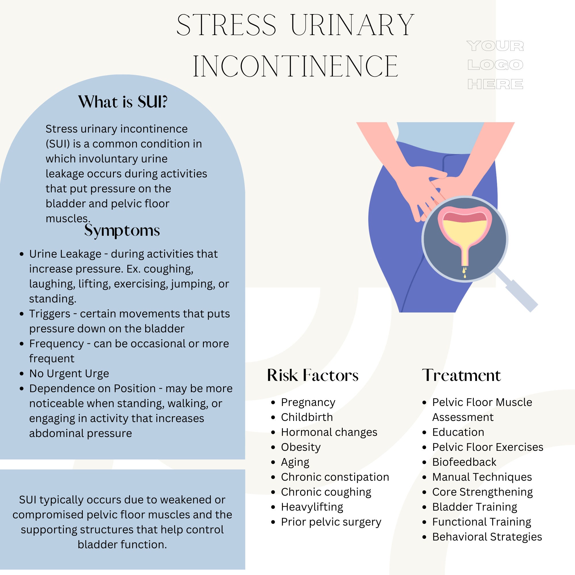 Stress Urinary Incontinence Handout Pelvic Floor Physical Etsy