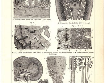 May include: A black and white anatomical illustration of the human digestive system, showing the small intestine, villi, liver, gallbladder, and kidney. The illustration is labeled with German text.