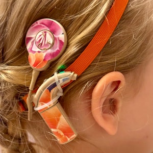 Stickers (flowers) for Cochlear implant  Nucleus 7