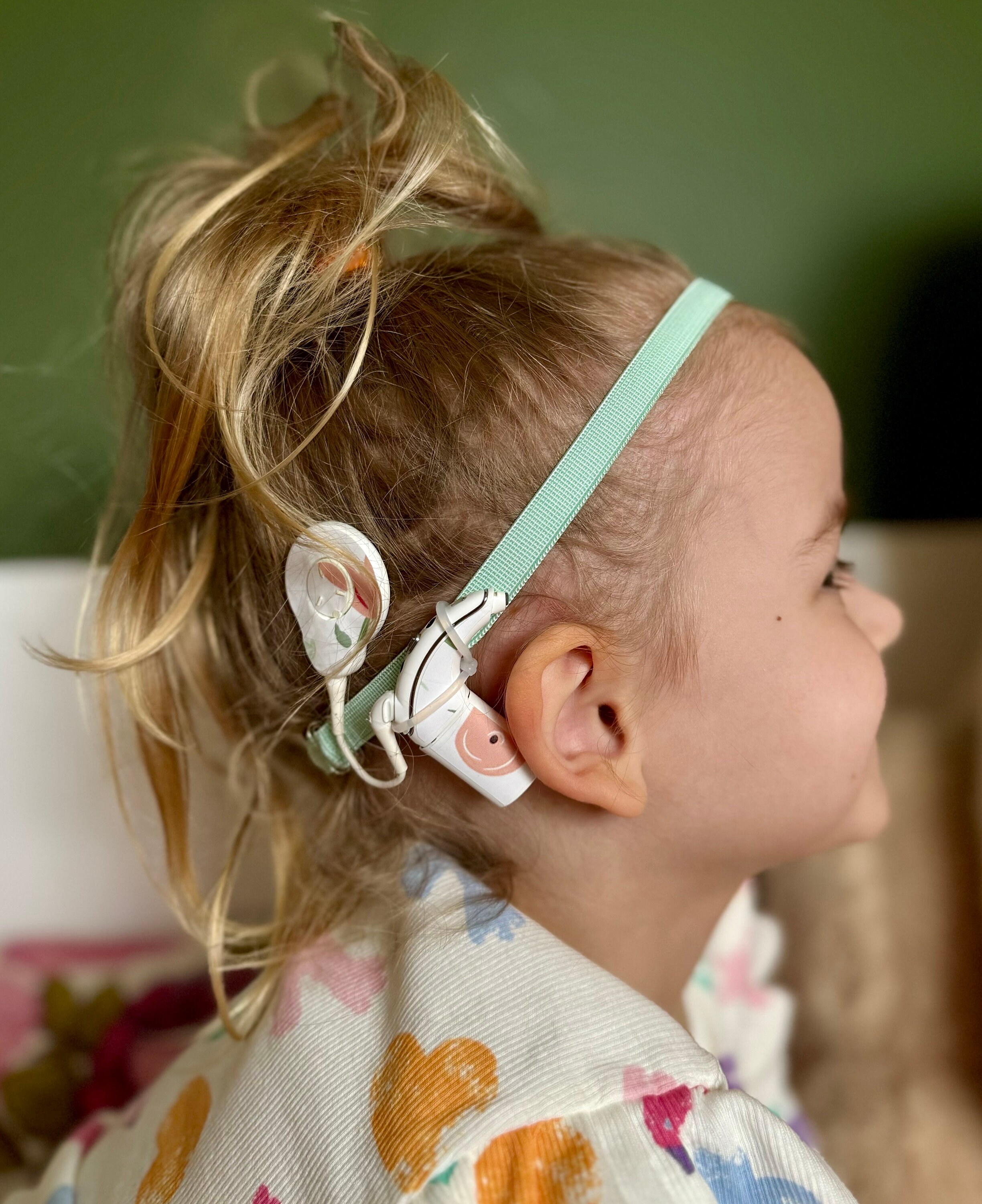 Stickers (white Flowers) for Cochlear Implant Nucleus 7 - Etsy