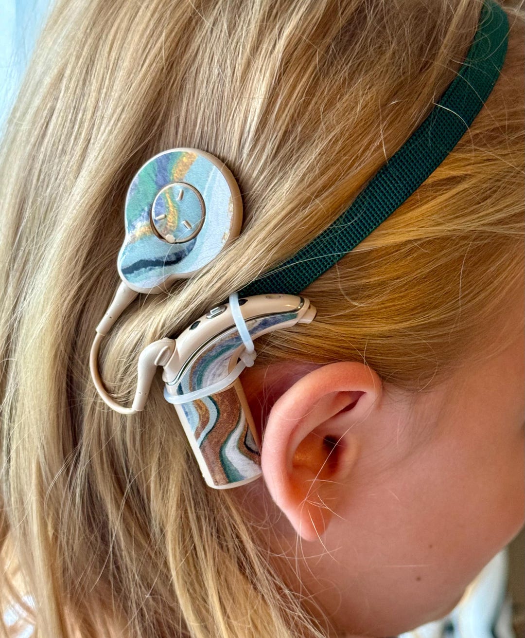 Cochlear Nucleus 7 Stickers – Amber Design - Etsy