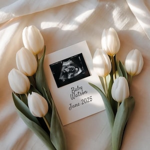Minimalistisches Schwangerschaftsanzeigefoto mit Ultraschallkarte, weißen Tulpen und sanfter Beleuchtung. Ideal für Baby offenbaren, elegant und zeitlos