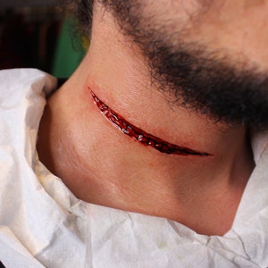 Cut Neck Prosthesis