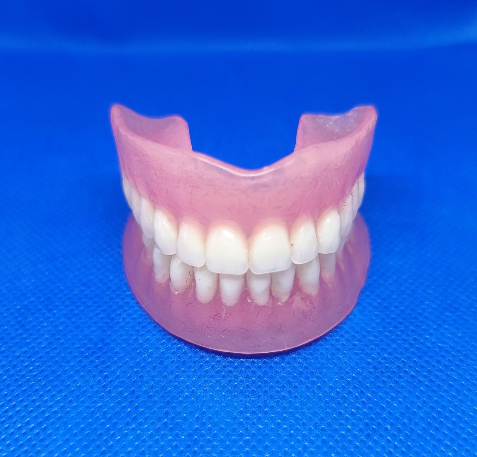 Horseshoe Upper Dentures Without Implantsprivacy - 1t8fpiy